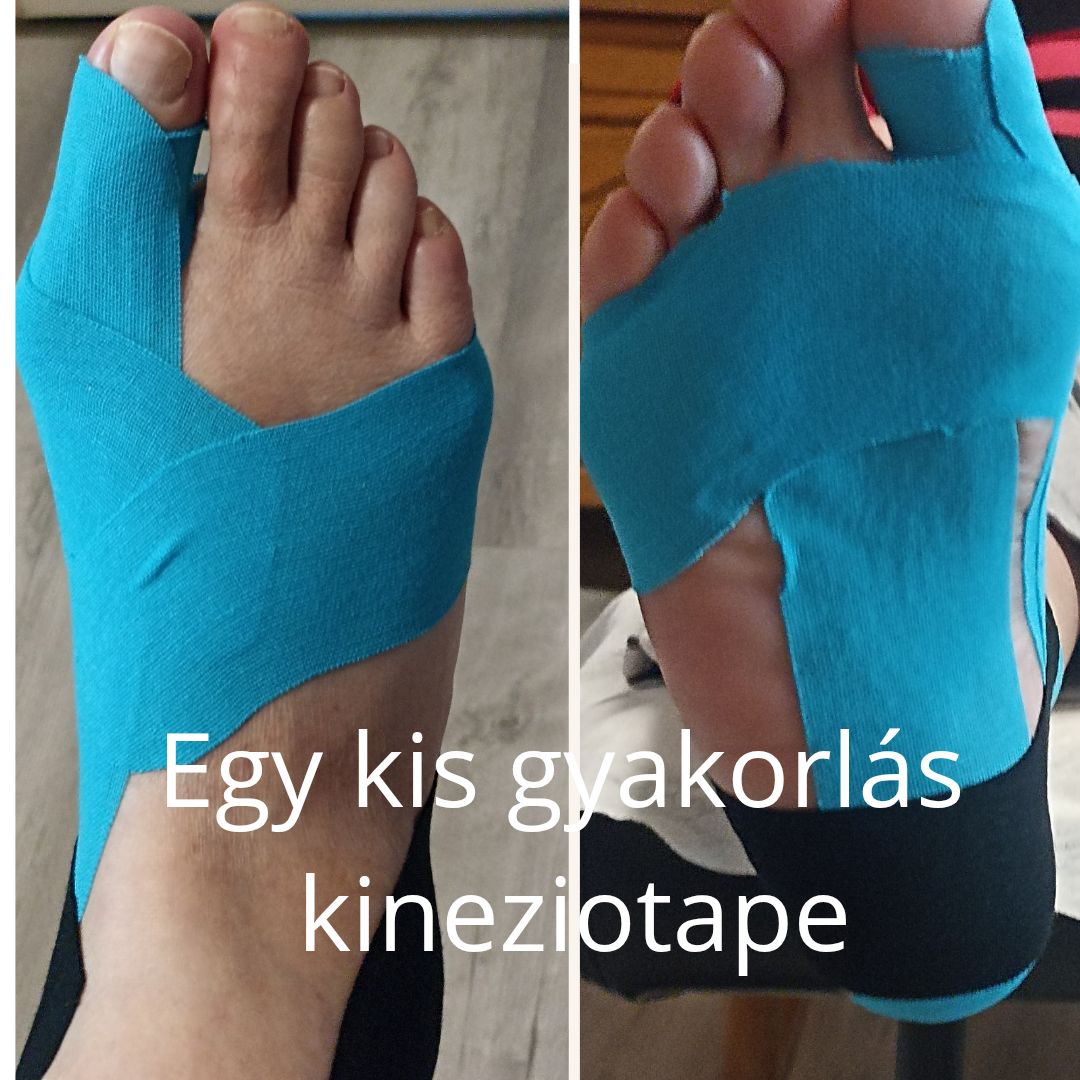 Kép 6